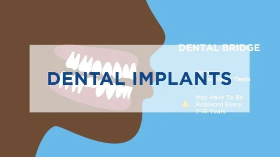Dental Implants vs Denture thumbnail