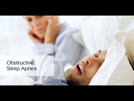 Obstructive Sleep Apnea thumbnail